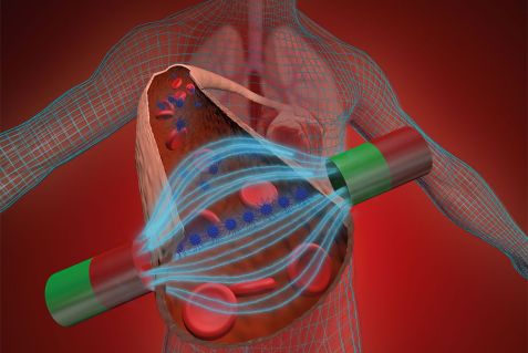 Iron oxide nanoparticles in a blood vessel