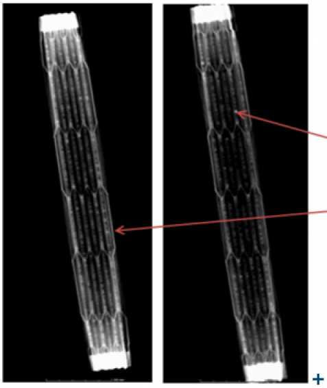 Radiography of a electrolysis cell