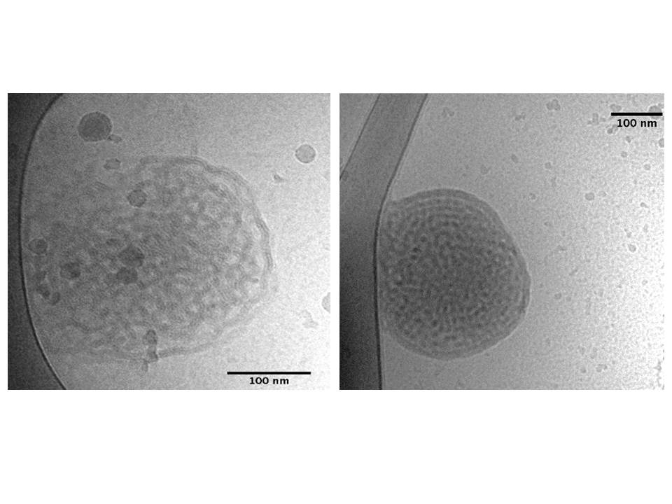 Structural insights into nanoparticles containing Gadolinium complexes ...